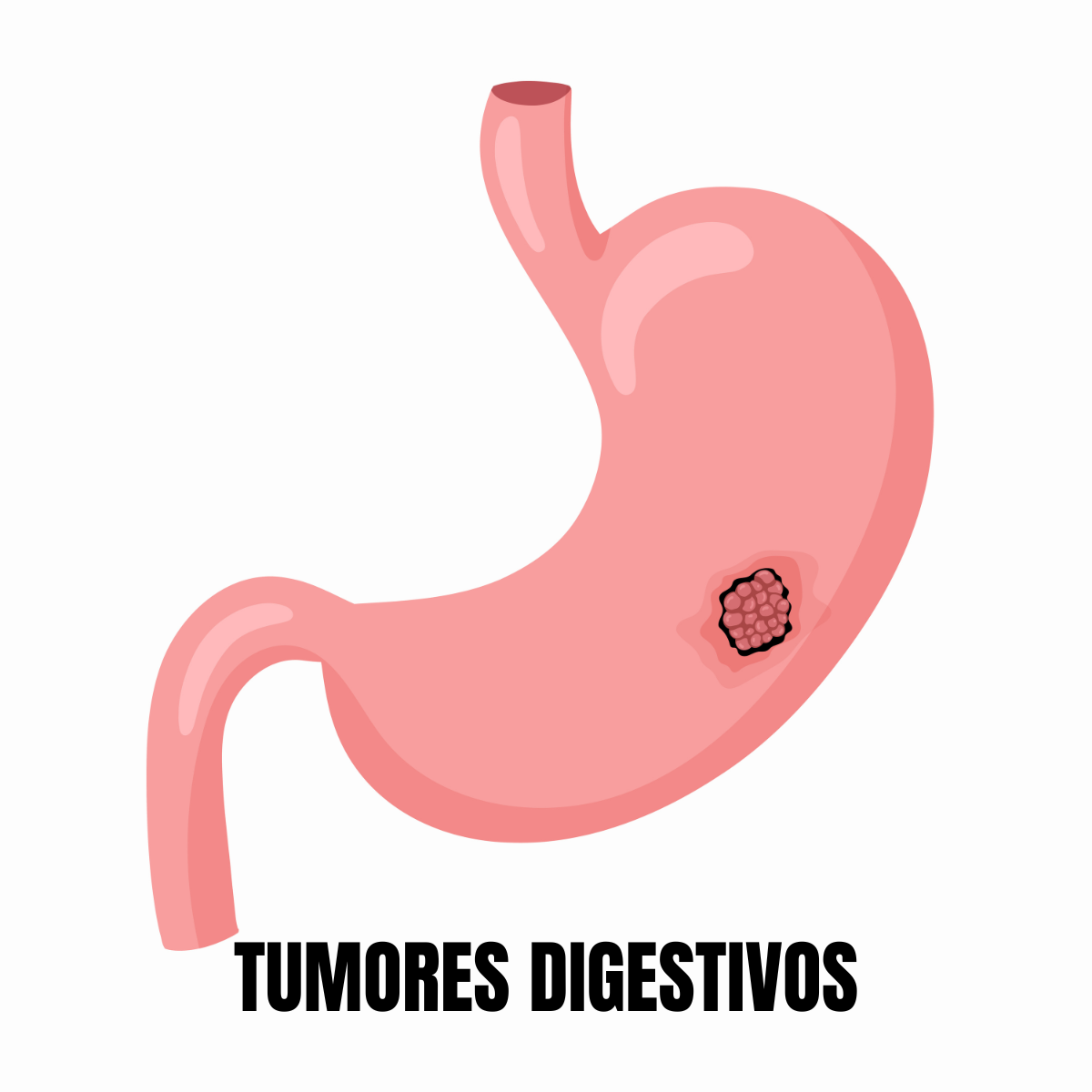 ilustración de un estómago en rosa y en el interior una zona pequeña redonda más oscura